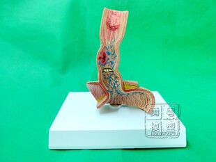 人体食管病变 食管病理 癌变 咽喉食管 食管解剖 食管展示