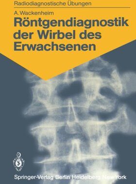 【预订】Rontgendiagnostik Der Wirbel Des Erw...