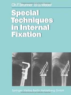 【预订】Special Techniques in Internal Fixation