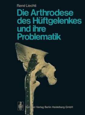 【预订】Die Arthrodese Des Huftgelenkes Und ...
