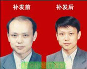 Extension mèches - Ref 225713 Image 1