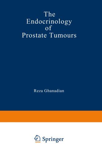 【预订】The Endocrinology of Prostate Tumours