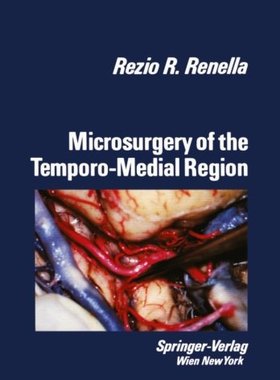【预订】Microsurgery of the Temporo-Medial Region