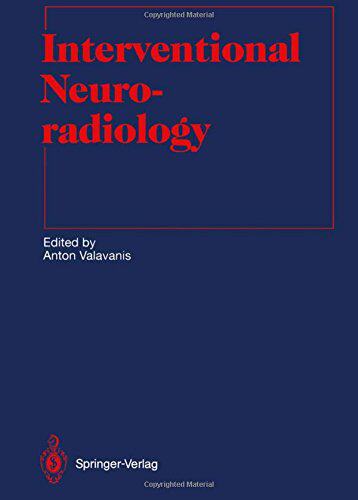 【预订】Interventional Neuroradiology