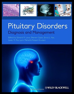 【预售】Pituitary Disorders Pituitary Disorders: Diagnosi