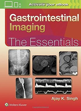 【预订】Gastrointestinal Imaging: The Essent...
