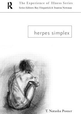 【预订】Herpes Simplex
