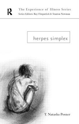 【预订】Herpes Simplex