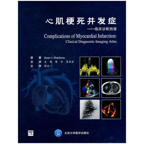 心肌梗死并发症－－临床诊断图谱（E)