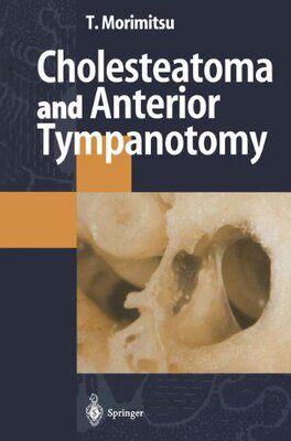 【预订】Cholesteatoma and Anterior Tympanotomy
