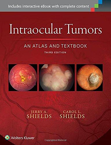 【预订】intraocular tumors: an atlas and textbook