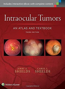 【预订】Intraocular Tumors: An Atlas and Textbook