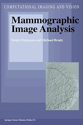 【预订】Mammographic Image Analysis