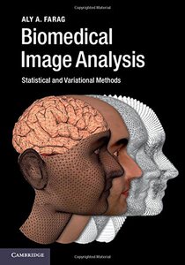 【预订】Biomedical Image Analysis