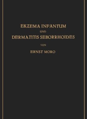 【预订】Ekzema Infantum Und Dermatitis Sebor...