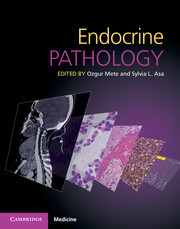 【预订】Endocrine Pathology with Online Resource