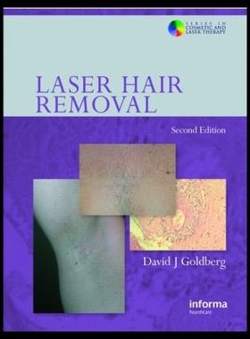 【预售】Laser Hair Removal