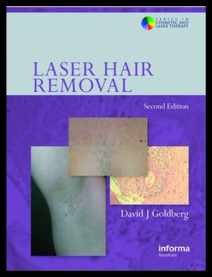 【预售】Laser Hair Removal