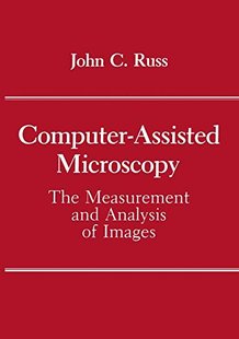 Assisted Computer Microscopy The ... Measurement 预售