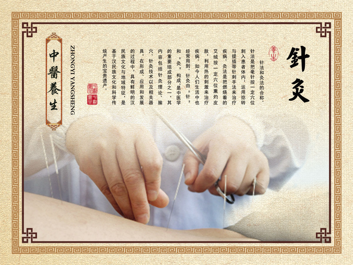 748海报印制展板写真喷绘18中医养生针炙的作用介绍挂图