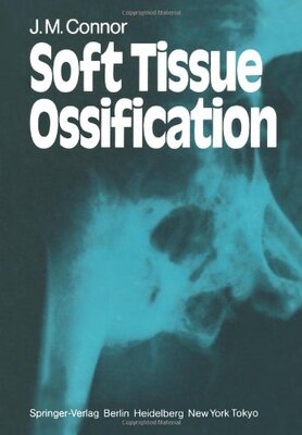 【预售】Soft Tissue Ossification