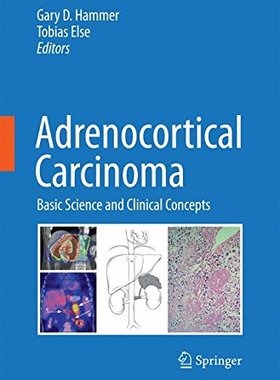 【预订】Adrenocortical Carcinoma