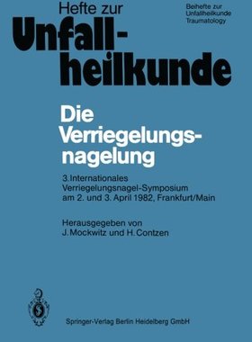 【预订】Die Verriegelungsnagelung: 3. Intern...