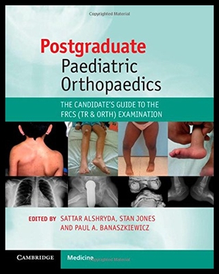 【预售】Postgraduate Paediatric Orthopaedics: The Candida