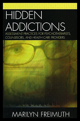 美国库房发货，通常付款后5-8周到货！