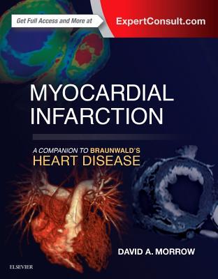 【预订】Myocardial Infarction