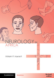 【预订】Neurology in Africa