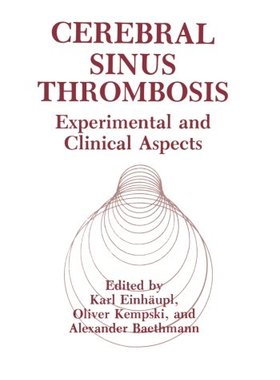 【预订】Cerebral Sinus Thrombosis: Experimen...