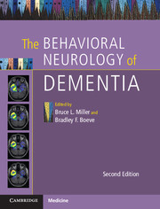 【预订】The Behavioral Neurology of Dementia