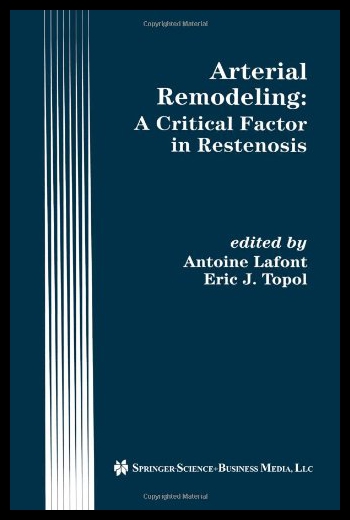 【预售】arterial remodeling: a critical factor in resteno