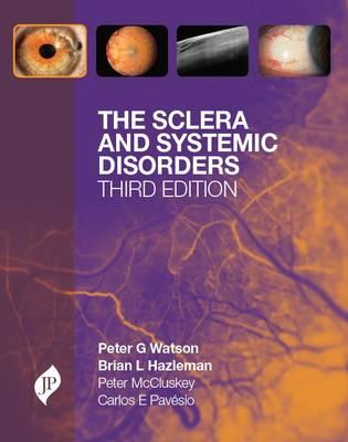 【预售】The Sclera and Systemic Disorders