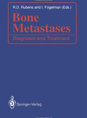 【预售】Bone Metastases: Diagnosis and Treatment
