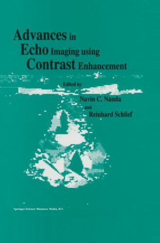 【预订】Advances in Echo Imaging Using Contr...