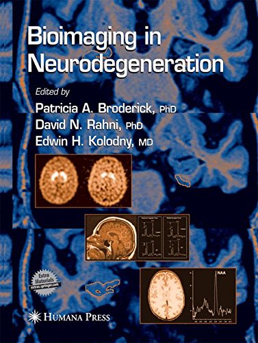 【预订】Bioimaging in Neurodegeneration