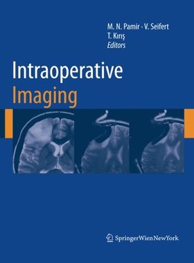 【预订】Intraoperative Imaging