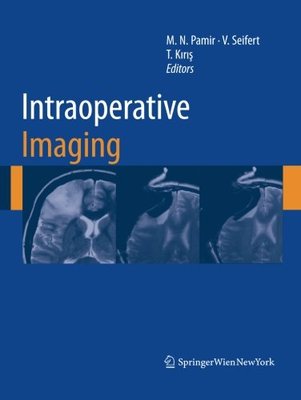 【预订】Intraoperative Imaging