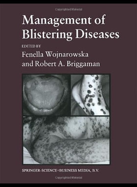 【预售】Management of Blistering Diseases