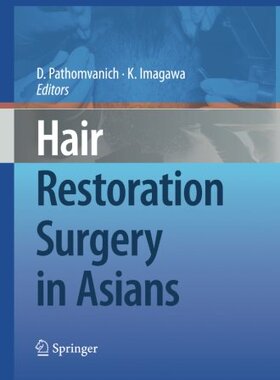 【预订】Hair Restoration Surgery in Asians