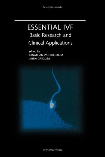 美国库房发货，通常付款后5-8周到货！