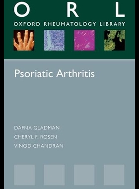 【预售】Psoriatic Arthritis