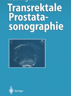 【预订】Transrektale Prostatasonographie