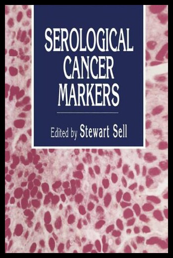 【预售】serological cancer markers