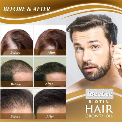 推荐Fast Hair Growth Spray Products Anti Hair Loss Serum Pre