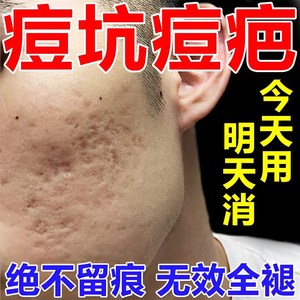 推荐痘坑凹洞修复男士女填充再生遮填旗舰店疤膏淡化毛孔粗大收缩