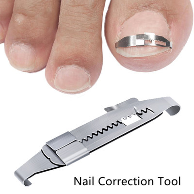 推荐Ingrown Toe Nail Correction Tool Toenail Straightening C