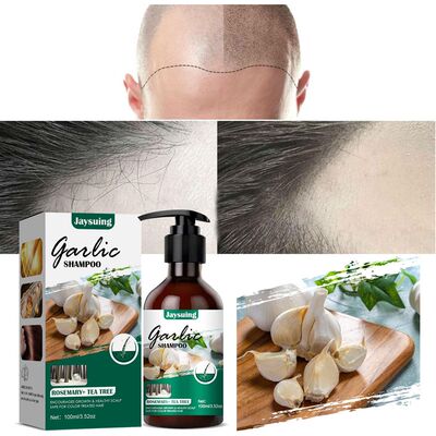 新品Free Shipping Professional Garlic Hair Growth Shampoo An